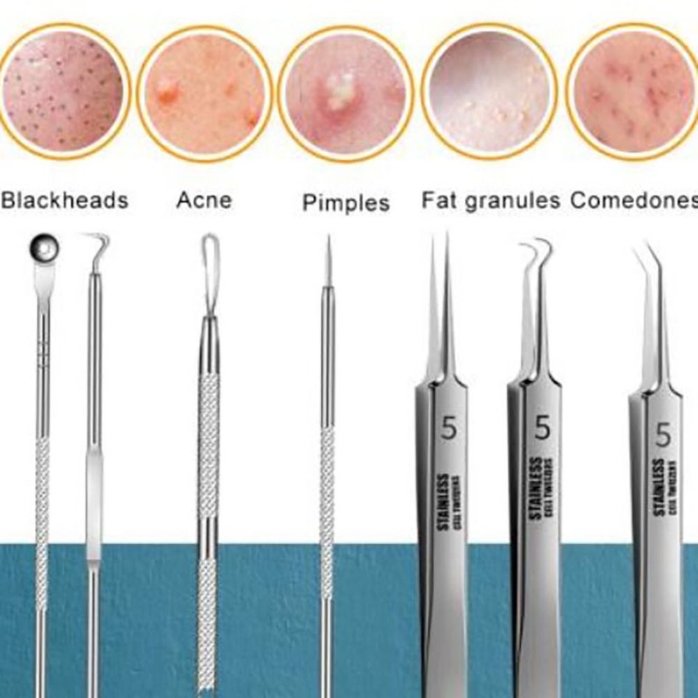 Acne Needle Removal Set
