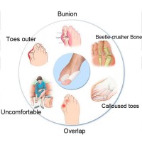 Diagram showing foot conditions with labeled parts and text